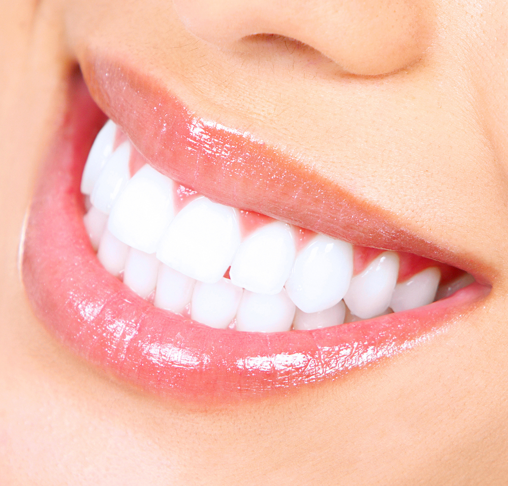 Smile Makeover West Bloomfield MI - Birmingham Center for Cosmetic Dentistry - Teeth-Whitening-1