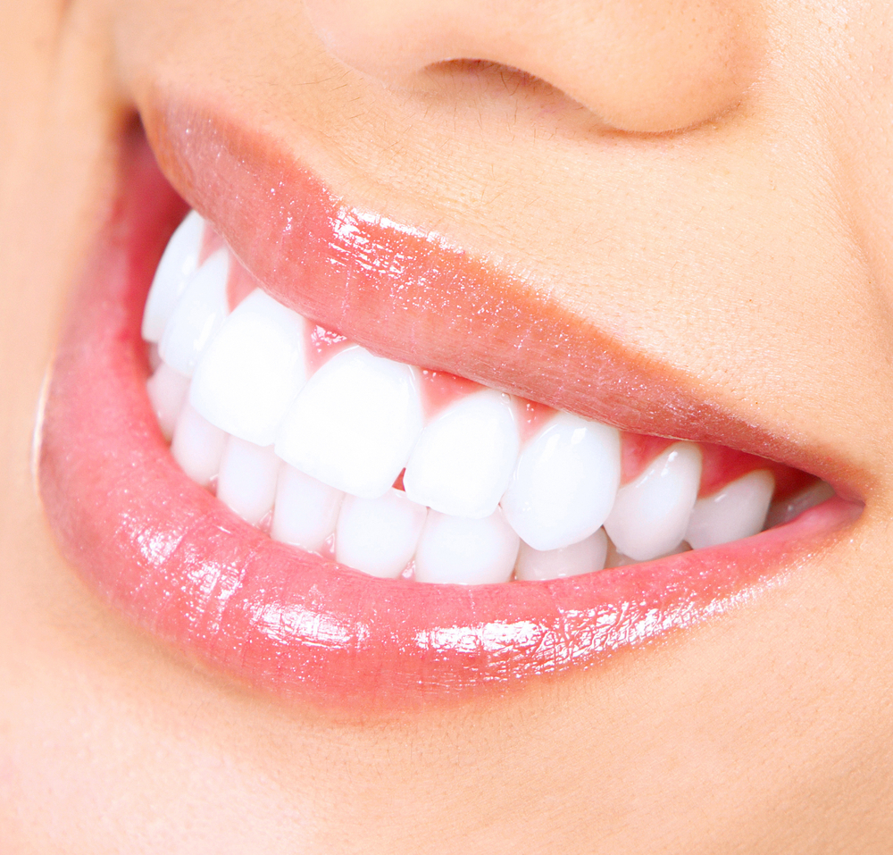 Teeth Whitening Bloomfield Township MI - Birmingham Center for Cosmetic Dentistry - Teeth-Whitening-1