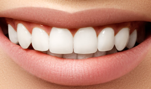 Invisalign Bloomfield Township MI - Birmingham Center for Cosmetic Dentistry - cosmetic-slide-2